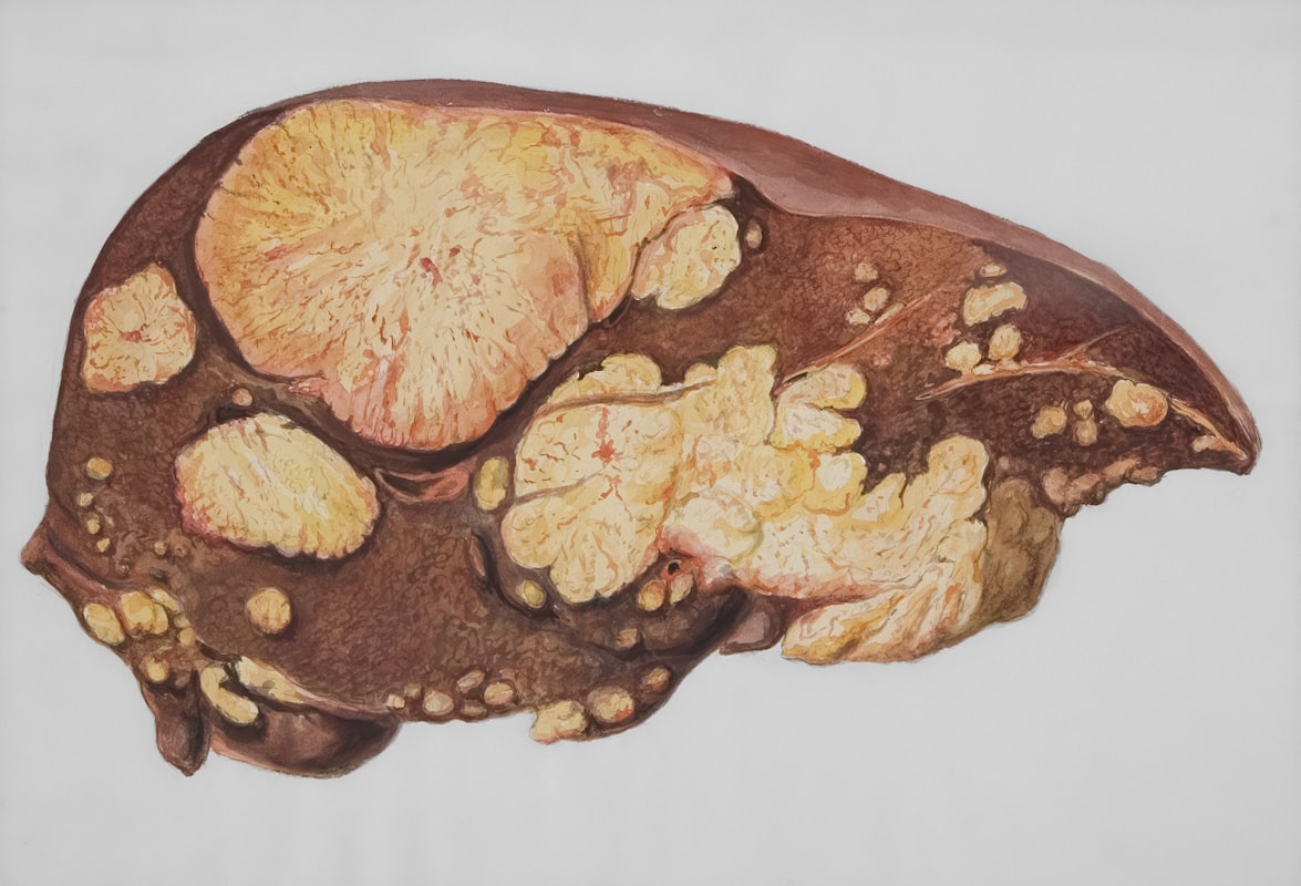 Hepatic Shield Complex